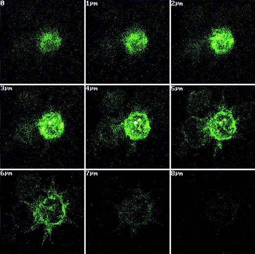 Fig. 2. Uptake of fluorescein-labeled recombinant Fab fragments by monocyte-derived dendritic cells. / Fluorescence-labeled recombinant Fab fragment was added to monocyte-derived LC at a concentration of 660 μg/mL immediately before terminal differentiation to DC with LPS. After DC differentiation, protein-loaded cells were pipetted onto adhesion slides and fixed with 3% paraformaldehyde. The location of fluorescence within the cells was assessed by confocal microscopy. In cells with DC morphology, bright fluorescence was present in cellular subcompartments with the typical shapes and localization of endosomes.
