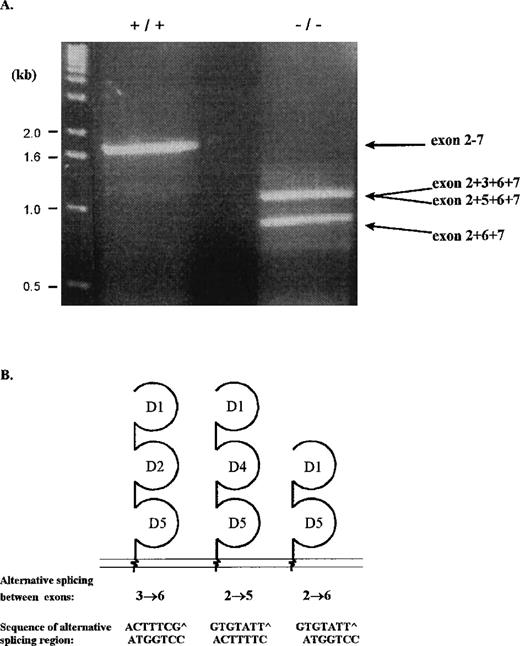 Fig. 3. RT-PCR analysis of alternatively spliced ICAM-1 RNA isoforms. / RT-PCR was performed on spleen RNA from wild-type and ICAM-1 mutant mice using 5′UTR and 3′UTR primers. (A) RT-PCR products resolved on a 1.5% agarose gel. For identification, fragments were transferred to a nitrocellulose membrane, which was hybridized with an exon 2-specific probe. Positive fragments were cloned and sequenced. Indicated on the diagram are short sequences of the exons joining the alternatively spliced sites. (B) Schematic representation of the ICAM-1 isoforms of ICAM-1–exon 4 mutant mice. The isoforms contain 2 or 3 extracellular domains, a transmembrane domain, and a cytoplasmic region.