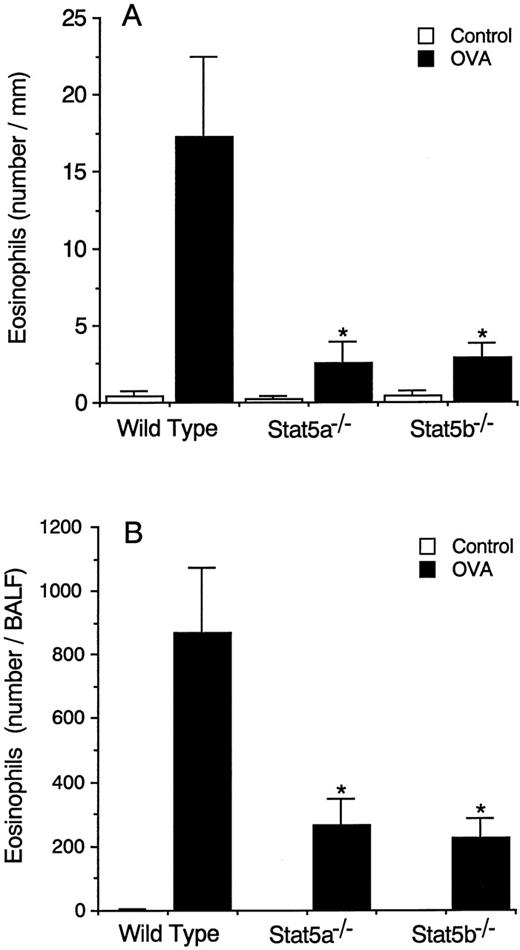Fig. 1. Antigen-induced eosinophil infiltration into the airways is diminished in both Stat5a−/− mice and Stat5b−/− mice. / (A) OVA-sensitized Stat5a−/− mice, Stat5b−/− mice, and littermate wild-type mice were challenged with the inhalation of OVA or saline (as control), and the number of eosinophils infiltrating into the submucosal tissue of trachea was evaluated at 24 hours after the inhalation. Data are means ± SD for 8 mice in each group. The mean values in Stat5a−/− mice and Stat5b−/− mice are significantly different from the mean value of wild-type mice, *P < .001. (B) Similar to A, the number of eosinophils in BALF was evaluated at 36 hours after the inhalation. Data are means ± SD for 5 mice in each group. *P < .005.