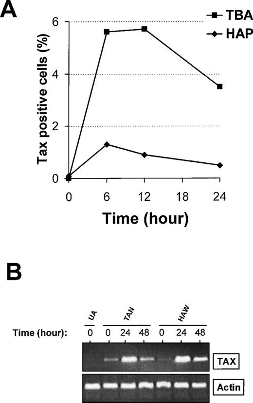 Fig. 3. Time course study of Tax protein (A) or messenger RNA (B) expression in peripheral blood mononuclear cells (PBMCs) isolated from asymptomatic carriers of human T-cell leukemia virus type I (HTLV-I) (HAP, HAW), from patients with HTLV-I-associated myelopathy/tropical spastic paraparesis (TBA, TAN), or from an uninfected individual (UA). / PBMCs were cultivated for various times, harvested, and then processed for the detection of Tax antigen (A: HAP, TBA) or mRNA (B: HAW, TAN, UA) expression. As a control, beta-actin messenger RNA expression was also investigated. One representative experiment of 3 is shown.
