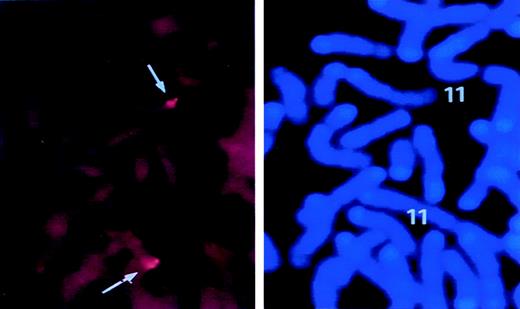 Fig. 1. FISH analysis for chromosomal localization of murinesurvivin locus. / Lymphocytes were isolated from mouse spleen and cultured as detailed in “Materials and Methods.” A biotin-labeled PAC DNA clone containing the entire survivin gene was hybridized with metaphase lymphocyte chromosomes. FISH signals and the DAPI banding pattern were recorded separately, and the assignment of FISH mapping data with chromosomal bands was achieved by superimposing FISH signals with DAPI-banded chromosomes. In the left panel, dots represent the specific FISH signals detected on chromosome 11. The right panel shows the same mitotic figure, stained with DAPI to identify mouse chromosome 11.