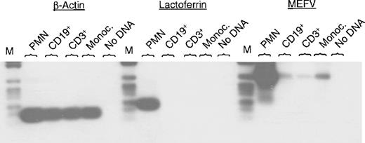 Fig. 1. Expression of MEFV mRNA in different populations of peripheral blood cells. / Total RNAs were isolated from the indicated subsets of leukocytes and subjected to RT-PCR using specific oligonucleotides for MEFV, lactoferrin, and β-actin. Amplification occurred for 30, 25, and 22 cycles, respectively. PCR fragments were separated by agarose gel electrophoresis, transferred to a nylon membrane, and hybridized with a gene-specific internal oligonucleotide labeled with DIG. (PMN = polymorphonuclear cells (neutrophils); Monoc. = monocytes; M = DNA length standard VI: 154, 220/234, 298, 394, 453, 517, 653, 1033 bp, Boehringer Mannheim.)