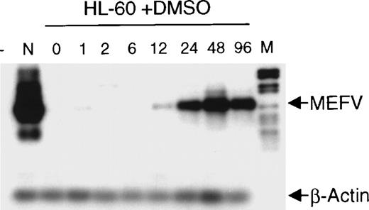 Fig. 2. Induction of MEFV during granulocytic differentiation of HL-60 cells. / HL-60 cells were incubated with 1.25% (v/v) DMSO to induce granulocytic differentiation. Total RNAs were isolated at the indicated times (hours) and subjected to semiquantitative RT-PCR and hybridization with specific oligonucleotides for MEFV and β-actin. PCR products were amplified for 25 cycles (MEFV) and 20 cycles (β-actin) to stay within the linear range. (- = no DNA; n = neutrophils, M = DNA length standard VI: 298, 394, 453, 517, 653, 1033, 1230, 1760, 2176 bp.)