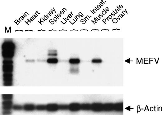 Fig. 3. Expression of MEFV in a collection of normal human tissue cDNAs. / cDNAs of normal human tissue were obtained (OriGene Technologies Inc, Rockville, MD), and PCR with specific primers for either MEFV(30 cycles) or β-actin (22 cycles) was performed. PCR fragments were blotted and hybridized with a gene-specific internal DIG-labeled oligonucleotide. (Sm. Intest. = small intestine; M = DNA length standard VI.)