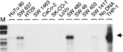 Fig. 4. MEFV expression in colon cancer cell lines. / Total RNAs were isolated from 11 human colon cancer cell lines. Expression of MEFV was analyzed by RT-PCR (30 cycles) and hybridization using an MEFV-specific oligonucleotide. As a negative control, RT-PCR was performed without DNA and, as a positive control, cDNA from monocytoid THP-1 cells was amplified. (M = DNA length standard VI: 298, 394, 453, 517, 653, 1033, 1230, 1760, 2176 bp.)