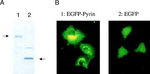 Fig. 5. Intracellular localization of pyrin. / COS-1 cells were transiently transfected with a vector expressing either EGFP or EGFP-pyrin. (A) Western blot analysis of transfected cells (lane 1: EGFP-pyrin, lane 2: EGFP vector control) using a monoclonal anti-GFP antibody. (B) COS-1 cells either transfected with an EGFP-pyrin or an EGFP expression vector were grown on cover slips and analyzed by fluorescent microscopy (1000 × magnification).