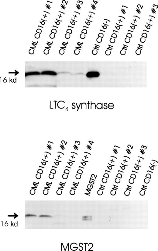 Fig. 5. Expression of LTC4-producing enzymes in normal and CML CD16+ neutrophils. / Microsomal fractions of CML CD16+ neutrophils, normal CD16+ neutrophils, normal CD16−eosinophil-enriched cell preparations (20 μg protein per sample), and an MGST2 standard obtained from MGST2-transfected Sf9 cells (1 μg protein) were electrophoresed through 14% polyacrylamide gels and electroblotted onto nitrocellulose. Immunoblot analysis was performed using antibodies against LTC4 synthase and MGST2, respectively.