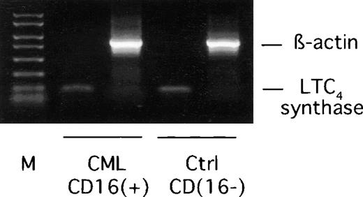 Fig. 6. RT-PCR analysis of LTC4 synthase mRNA expression in CML CD16+ neutrophils. / Total RNA was extracted from CML CD16+ neutrophils and normal CD16− eosinophil-enriched cell preparations and used as templates in RT-PCR reactions using LTC4synthase or β-actin specific primers. M represents a 50-2000 bp molecular weight marker. The expected lengths of amplification products are 119 bp (LTC4 synthase) and 784 bp (β-actin). One representative experiment out of 4 is shown.