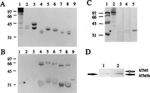 Fig. 3. TM5 and TM5b are the 2 major TM isoforms in human erythrocyte membranes. / (A) A Coomassie blue stain of several purified TM isoforms and their chimeric molecules separated on a 12% gel using SDS-PAGE. (B) The Western blot analysis of the above, with antibody R-41. Samples are 30 μg human ghost membrane (lane 1), chicken leg TM (lane 2), chicken gizzard TM (lane 3), hTM5/2 (lane 4), hTM2 (lane 5), hTM3 (lane 6), hTM5 (lane 7), hTM5/3 (lane 8), and hTM3/5 (lane 9). Approximately 10 μg TM isoforms (except hTM3/5, which has less) are applied. (C) The following lanes depict the Western blot analysis of 30 μg human ghost membrane by mAb Pep3-431:100 (lane 3), antibody R-411:100 (lane 4), and mAb LC11:500(lane 5). The panel also depicts the Coomassie blue stains of human ghost membrane (lane 2) and the molecular weight standards (lane 1). (D) A sequential Western blot analysis demonstrates the distinction between hTM5 and hTM5b. Lane 1 presents the first round of Western blot with mAb Pep3-43,1:100 while lane 2 shows the same strip after the second round of Western blot with mAb LC1.1:1000