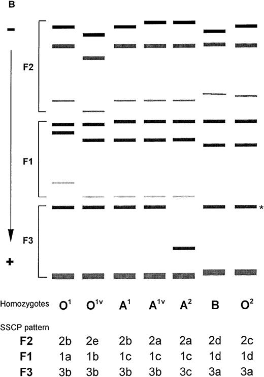 Fig. 1. Multiplex PCR-SSCP analysis for the determination of the ABO genotypes. / (A) The SSCP banding patterns for homozygotes (for O1, O1v, A1, A1v, and B) and heterozygotes (for less common alleles A2 and O2). (B) Schematic drawing showing the standard SSCP banding patterns for the 7 common ABO alleles, together with their designations. Note that the homozygous patterns for A2 and O2 are deduced from the heterozygous patterns. For alleles B and O2, the weakly stained fastest-moving band of the F1 fragment overlaps with the strongly stained slowest-moving band of the F3 fragment marked by asterisk (*). (C) The SSCP banding patterns for representative samples containing rare alleles, together with some common phenotypes (O1O1v and A1A2) for comparison. The rare alleles are designated as Av1, and Ov1 to Ov7.