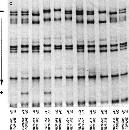 Fig. 1. Multiplex PCR-SSCP analysis for the determination of the ABO genotypes. / (A) The SSCP banding patterns for homozygotes (for O1, O1v, A1, A1v, and B) and heterozygotes (for less common alleles A2 and O2). (B) Schematic drawing showing the standard SSCP banding patterns for the 7 common ABO alleles, together with their designations. Note that the homozygous patterns for A2 and O2 are deduced from the heterozygous patterns. For alleles B and O2, the weakly stained fastest-moving band of the F1 fragment overlaps with the strongly stained slowest-moving band of the F3 fragment marked by asterisk (*). (C) The SSCP banding patterns for representative samples containing rare alleles, together with some common phenotypes (O1O1v and A1A2) for comparison. The rare alleles are designated as Av1, and Ov1 to Ov7.