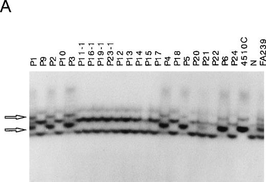 Fig. 1. Detection of IVS4 mutation by PCR-SSCP and subsequent direct sequencing. / (A) Representative PCR-SSCP analyses using the primer set for exon 4 boundaries. 4510C cells are homozygous for the IVS4 mutation; FA239 cells are heterozygous (IVS4/wt) for this segment; and N indicates normal control. The patient numbers correspond to those in Table 1. Arrowheads indicate mobility shifts of the PCR products from the genomic DNA from the patients, P1, P2, P3, P4, P5, and P6. (B) Representative sequencing results. Direct sequencing of aberrant bands from P1 identified an A to T transition of the fourth base in intron 4 (indicated by arrows).