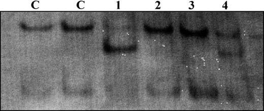 Fig. 1. SSCP analysis of G6PD exon 8. / Results obtained with hematopoietic cells of the patient, mother and sister (lanes 1, 2 and 3, respectively) and with the patient's buccal cells (lane 4).