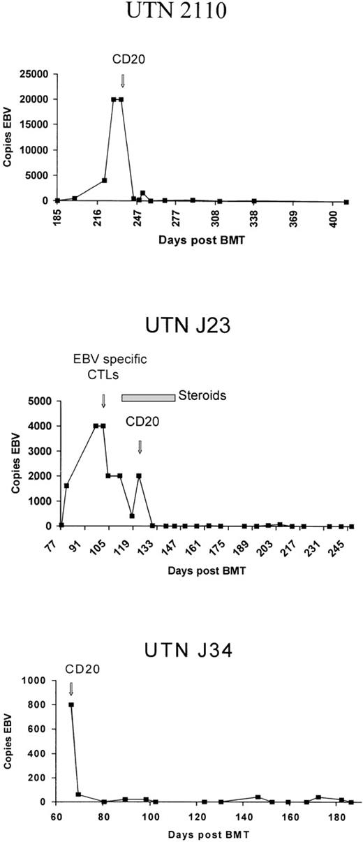 Fig. 1. Epstein-Barr virus DNA levels in 3 patients before and after administration of rituximab.