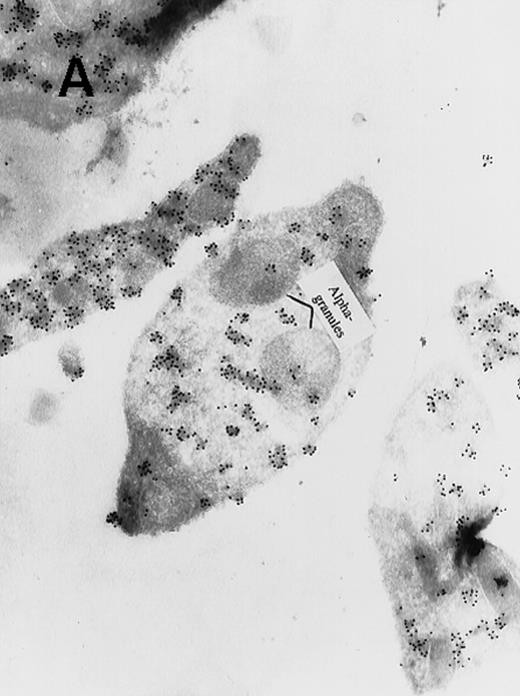 Immunogold Electron Microscopic assays (performed as described before)9. / (A) Ultrathin frozen sections of rat platelets immunolabeled with antibodies to ERK (magnification ×45 000). (B) Well-developed demarcation membranes in a rat (Wistar), TPO-treated megakaryocyte79 immunostained with an antibody to Mst1 (magnification ×48 000), or (C) with an antibody to ERK, which recognizes ERK1 and ERK2 (magnification ×65 400). The arrows point to the demarcation membranes. The Mst1 antiserum (gift of Dr Jonathan Chernoff, Fox Chase Cancer Center, Philadelphia, PA) and anti-ERK2 (K-23) (Santa Cruz Biotechnology, Santa Cruz, CA) or TR2, anti-ERK (gift of Michael Weber, University of Virginia Medical School) were diluted 1:10.