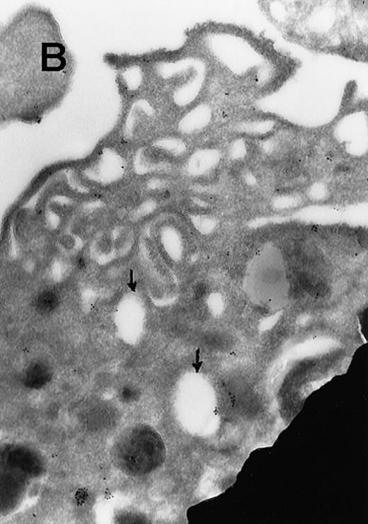 Immunogold Electron Microscopic assays (performed as described before)9. / (A) Ultrathin frozen sections of rat platelets immunolabeled with antibodies to ERK (magnification ×45 000). (B) Well-developed demarcation membranes in a rat (Wistar), TPO-treated megakaryocyte79 immunostained with an antibody to Mst1 (magnification ×48 000), or (C) with an antibody to ERK, which recognizes ERK1 and ERK2 (magnification ×65 400). The arrows point to the demarcation membranes. The Mst1 antiserum (gift of Dr Jonathan Chernoff, Fox Chase Cancer Center, Philadelphia, PA) and anti-ERK2 (K-23) (Santa Cruz Biotechnology, Santa Cruz, CA) or TR2, anti-ERK (gift of Michael Weber, University of Virginia Medical School) were diluted 1:10.