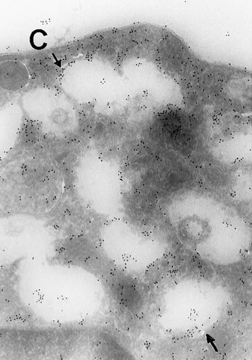 Immunogold Electron Microscopic assays (performed as described before)9. / (A) Ultrathin frozen sections of rat platelets immunolabeled with antibodies to ERK (magnification ×45 000). (B) Well-developed demarcation membranes in a rat (Wistar), TPO-treated megakaryocyte79 immunostained with an antibody to Mst1 (magnification ×48 000), or (C) with an antibody to ERK, which recognizes ERK1 and ERK2 (magnification ×65 400). The arrows point to the demarcation membranes. The Mst1 antiserum (gift of Dr Jonathan Chernoff, Fox Chase Cancer Center, Philadelphia, PA) and anti-ERK2 (K-23) (Santa Cruz Biotechnology, Santa Cruz, CA) or TR2, anti-ERK (gift of Michael Weber, University of Virginia Medical School) were diluted 1:10.