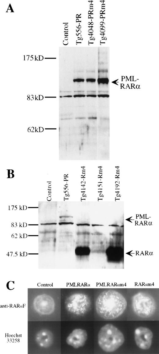 Fig. 2. Expression of the transgenes. / A, B, Whole cell lysates of bone marrow were subjected to denaturing PAGE and Western blotting using a rabbit polyclonal antihumanRARαF domain antibody. Signals corresponding to transgenically expressed PMLRARα and RARα proteins are indicated by arrows. Locations of size markers are indicated by lines. (A) Protein expression in nonleukemic bone marrow of the highest expressing MRP8-PMLRARα transgenic line (Tg556-PR) and in 2 of the MRP8-PMLRARαm4 mice, Tg4048-PRm4 (nonleukemic bone marrow) and Tg4099-PRm4 (leukemic bone marrow). 8% SDS-polyacrylamide. (B) Protein expression in nonleukemic bone marrow Tg556-PR and in the marrows of healthy MRP8-RARαm4 transgenic mice from 3 lines, Tg4142-Rm4, Tg4151-Rm4, and Tg4192-Rm4. 12% SDS-polyacrylamide. C, Immunofluorescence analysis of bone marrow neutrophilic cells, anti-RARαF antiserum and Hoechst 33258, 1300 × .