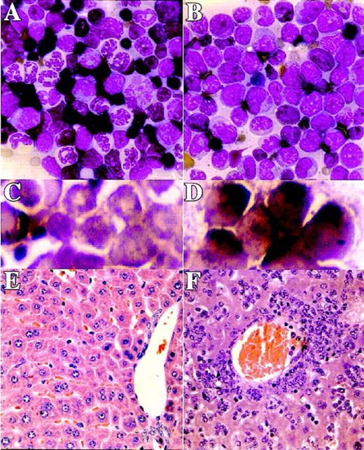 Fig. 3. Acute leukemia in MRP8-PMLRARm4 transgenic mice. / (A, C, E) Samples from control mice. (B, D, F) Samples from leukemicPMLRARαm4 mice. (B) Founder 4099. (D) Transplanted leukemia 4048.2. (F) founder 4042. (A, B) Bone marrow, Wright's Giemsa stain, 500 × . (C, D) Bone marrow, Sudan Black B stain, 965 × . (E, F) Liver, Hematoxylin and eosin stain, 200 × .