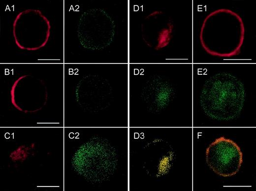 Fig. 3. Localization of CXCR2 expression and of the expression of rab11+ endosomes by confocal analysis. / CXCR2-expressing HEK 293 cells were incubated with or without 1000 ng/mL GCP-2, at 37°C for 1, 5, and 60 minutes. The GCP-2–exposed cells were subdivided into 2 groups. One group of cells was washed and stained immediately after exposure to GCP-2 with anti-CXCR2 and anti-rab11–specific antibodies, as described in “Materials and methods.” The cells of the other group were washed and allowed to recover at 37°C for 90 minutes, in the presence or absence of 10 μg/mL cycloheximide. The cells were washed and stained with anti-CXCR2 and anti-rab11–specific antibodies, and subjected to confocal analysis as described in “Materials and methods.” In all the pictures shown, the red color represents the expression of CXCR2, as distinguished by the staining with rabbit antibodies against CXCR2, followed by rhodamine-conjugated antibodies against rabbit IgG. The green color, in all the pictures shown, represents the expression of rab11, as distinguished by the staining with mouse antibodies against rab11, followed by fluorescein isothiocipnate (FITC)-conjugated antibodies against mouse IgG. The yellow color indicates the colocalization of CXCR2 with rab 11 expression. (A) The expression of CXCR2 and rab11 prior to exposure to GCP-2. (B, C, D) The localization of CXCR2 and rab11 expression following the exposure of the cells to GCP-2 for 1, 5, and 60 minutes, respectively. (E) The expression of CXCR2 and rab11 after induction of internalization and recovery at 37°C for 1.5 hours in the absence of cycloheximide. (F) The same as in (E), in the presence of cycloheximide. Reference bars in the lower right corners of selected sections represent 10 μm. A representative experiment of 2 to 4 performed is shown.