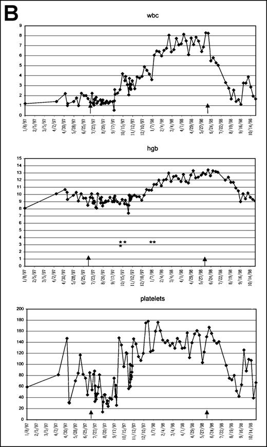 Fig. 2. Graphic presentation of peripheral blood indices in 4 (A-D) patients treated with PCD and amifostine. / *2 U PRBC transfusion.