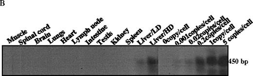 Fig. 4. Molecular analysis of the mice receiving injection of rAAV/DLZ6. / A. Diagram of primers designed for detection of rAAV DNA. B. Distribution of rAAV in mice following portal vein injection. A unique 450 bp fragment of rAAV/DLZ6 was amplified to detect distribution of rAAV after hepatic injection. DNA isolated from brain, spinal cord, muscle, bone marrow, heart, lung, testis, lymph node, kidney, intestine, and spleen were analyzed following sacrifice of a mouse receiving high-dose rAAV/DLZ6. Liver/LD and Liver/HD refer to DNA PCR analysis of animals receiving low- and high-dose rAAV/DLZ6. Standard curve 5, 1, 0.2, 0.1, 0.01, and 0 genome copy equivalents of plasmid pDLZ6 diluted with genomic mouse DNA. C. Diagram of the primers designed for RT/PCR. D. RT-PCR analysis of total RNA isolated from control and experimental animals. Primers were designed to amplify a 534-bp BDD-hFVIII specific fragment. –RT control employed RNA isolated from the mouse liver receiving high-dose rAAV/DLZ6. The negative control used RNA isolated from control animal. RNA samples of muscle, brain, lymph nodes, testis, kidney, and spleen were from the mouse receiving high-dose rAAV/DLZ6. LD: liver RNA isolated from mouse receiving low-dose AAV/DLZ6. HD: liver RNA isolated from mouse receiving high-dose rAAV/DLZ6. E. Sph I digestion of Diagram of the restriction digestion using Sph I. F. Southern blot analysis of high molecular weight genomic DNA and Hirt DNA isolated from experimental animals. Standard curve: genomic DNA from control mouse liver with 5, 1, 0.2, and 0.02 genome copy equivalents of plasmid pDLZ6 per cell, respectively. HMW genomic DNA and low molecular wt liver DNA (HIRT) isolated from animals receiving high-dose rAAV/DLZ6.
