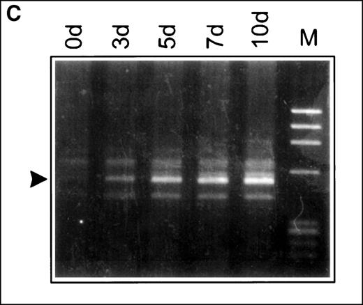 Fig. 4. Induced up-regulation of the membrane-bound hIL-5R isoform by IL-5. / (A) Flow cytometry plots of FDC-P1-MINI-1.1 cells labeled with the lipophilic chromophore PKH2-GL. Cell growth in human IL-5 (bottom panel) showed a single population, which parallels spontaneous autocrine outgrowth (middle panel). If a fast proliferating subpopulation were present, dilution of the fluorescent dye would be much more pronounced and would approach fluorescence intensities as shown for cells grown in IL-4-containing medium (top panel). Representative of 2 independent experiments. (B) RT-PCR analysis of IL-5Rα isoform mRNA expression by FDC-P1-MINI-1.1 cells grown in medium containing EL4 CM, IL-5 alone, IL-4 alone, or IL-4 and IL-5 combined. The upper part of each panel shows the products of a competitive PCR; the lower part represents PCR data using primers for the TM-transcript only. TM-transcripts are detected in the presence of IL-5, but also, although at a lower level, and with slower kinetics in the presence of IL-4 plus IL-5. Representative of 2 independent experiments. (C) FDC-P1-MINI-1.1 cells transfected with the pSVZeo-mIL-5Rα vector, which directs the expression of the murine IL-5Rα subunit, will grow in the presence of murine IL-5, independent of hIL-5. Under these conditions, switch of isoform expression of hIL-5Rα transcripts from the minigene was also observed (arrow). Sampling time points are shown. Representative of 2 independent experiments.