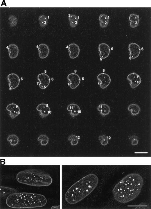 Fig. 2. Examples of the analysis of chromocenters in lymphocytes and fibroblasts using confocal microscopy. / (A) Optical series of a lymphocyte nucleus hybridized with the pan-centromeric probe. A reduced number of hybridization signals is observed, corresponding to the coalescence of signals originated by individual centromeres. Note that most of the signals are visible in several sequential optical sections. (B) Analysis of chromocenters in quiescent human fibroblasts. Optical sections obtained in different nuclei. Bars, 10 μm. The nuclear lamina is labeled with an anti-laminin B antibody.