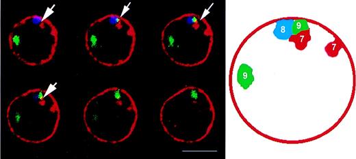 Fig. 3. Optical sections of a lymphocyte nucleus showing the clustering of 3 different centromeres (arrows). / The respective chromosome numbers are indicated on the diagram on the right. Note the proximity of 3 centromeres to the nuclear lamina (see text), which is labeled with an anti-laminin B antibody (red). Bar, 5 μm.