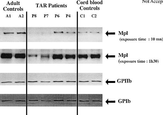Fig. 6. Western blot analysis of Mpl, GPIIb, and GPIb expression in platelets from normal adult controls, newborns, and TAR syndrome patients. / Platelet lysates (20 μg) were separated by SDS-PAGE and probed with polyclonal antibodies against Mpl, GPIIb, and GPIbα.