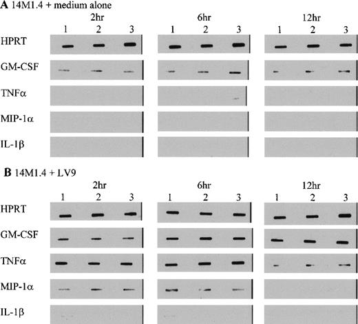 Fig. 6. L donovani infection of 14M1.4 cells induces selective accumulation of cytokine/chemokine mRNA. / 14M1.4 cells were untreated (A) or infected with amastigotes (B) for 1 hour at 37°C. Infected and naive samples were then washed and resuspended in TRI-reagent in preparation for RNA extraction, or incubated for up to 12 hours before resuspension in TRI-reagent. mRNA accumulation was measured by RT-PCR. Data illustrate PCR products visualized by Southern blotting and enhanced chemiluminescence detection. Bands represent PCR products from 3 individual samples at 2 hours, 6 hours, and 12 hours after infection.