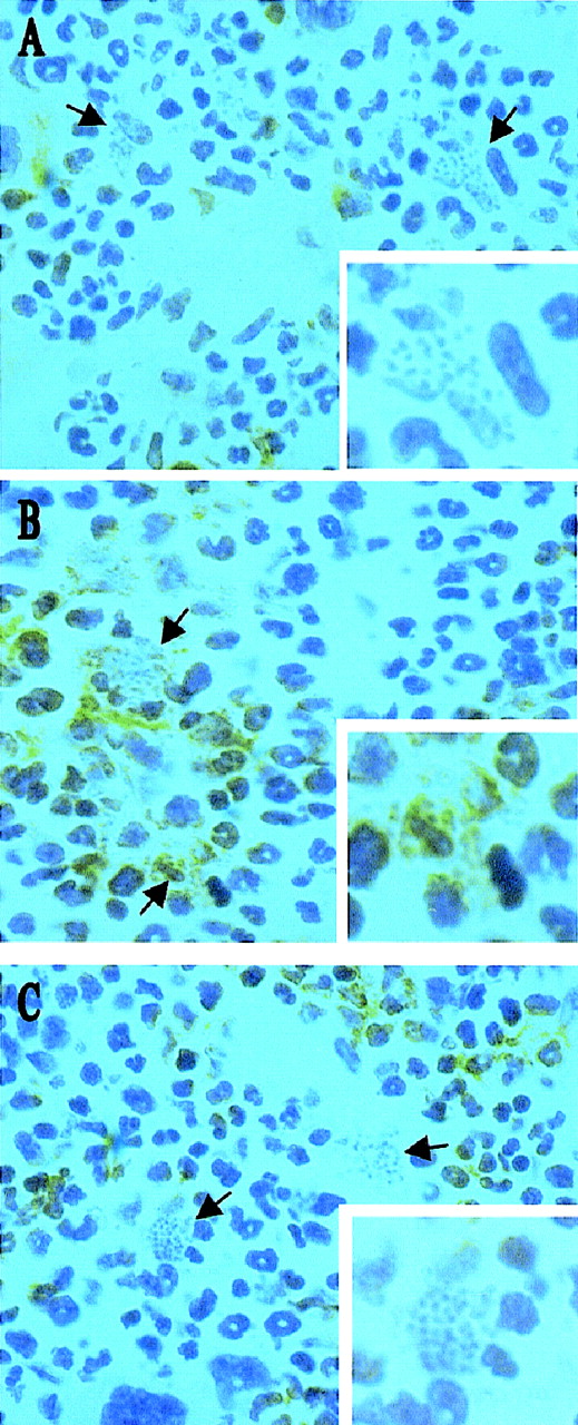 Fig. 1. L donovani infects stromal macrophages but not progenitor cells in the bone marrow of BALB/c mice. / Whole femurs were removed from BALB/c mice at day 28 after infection, decalcified, and stained for CD34 (A) and SER 4 (B and C). Sections were counterstained with Harris hematoxylin. Arrows indicate cells containing L donovani amastigotes (magnification × 100). Insert shows a single L donovani-infected cell (magnification × 200).