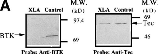 Fig. 6. Analysis of platelets from XLA patients. / Soluble extracts were prepared from patient A or a normal control (3 × 106 platelets/sample) and were then subjected to immunoblot analysis with (A) Btk or Tec antiserum. Collagen-stimulated tyrosine phosphorylation of Tec was analyzed as described in the legend to Figure 1D, and analyses are given for (B) patient A and (C) patient B. Tyrosine phosphorylation of (D) WASP or (E) Slp-76 in XLA platelets prior to or after 50 μg/mL collagen treatment for 5 minutes was examined by immunoblot analysis with 4G10 antibody following immunoprecipitation (anti-WASP or anti–Slp-76, patient B). The upper and lower portions of the membrane from the (E) anti–Slp76 immunoprecipitate was immunoblotted with anti-Fyb/Slp-130 or anti–Slp-76 as indicated. Tec and WASP phosphorylation studies were also performed using platelets from patients C-G, and similar results were obtained.
