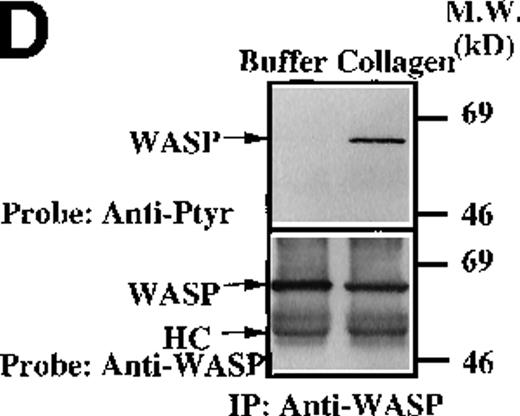 Fig. 6. Analysis of platelets from XLA patients. / Soluble extracts were prepared from patient A or a normal control (3 × 106 platelets/sample) and were then subjected to immunoblot analysis with (A) Btk or Tec antiserum. Collagen-stimulated tyrosine phosphorylation of Tec was analyzed as described in the legend to Figure 1D, and analyses are given for (B) patient A and (C) patient B. Tyrosine phosphorylation of (D) WASP or (E) Slp-76 in XLA platelets prior to or after 50 μg/mL collagen treatment for 5 minutes was examined by immunoblot analysis with 4G10 antibody following immunoprecipitation (anti-WASP or anti–Slp-76, patient B). The upper and lower portions of the membrane from the (E) anti–Slp76 immunoprecipitate was immunoblotted with anti-Fyb/Slp-130 or anti–Slp-76 as indicated. Tec and WASP phosphorylation studies were also performed using platelets from patients C-G, and similar results were obtained.