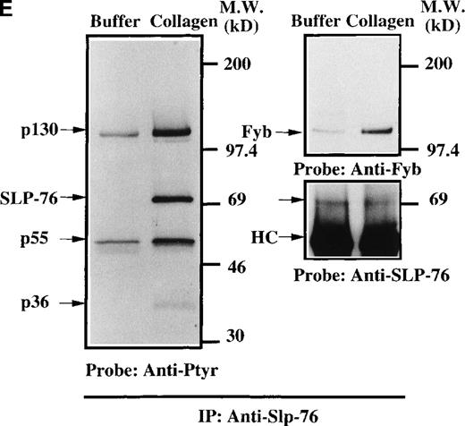 Fig. 6. Analysis of platelets from XLA patients. / Soluble extracts were prepared from patient A or a normal control (3 × 106 platelets/sample) and were then subjected to immunoblot analysis with (A) Btk or Tec antiserum. Collagen-stimulated tyrosine phosphorylation of Tec was analyzed as described in the legend to Figure 1D, and analyses are given for (B) patient A and (C) patient B. Tyrosine phosphorylation of (D) WASP or (E) Slp-76 in XLA platelets prior to or after 50 μg/mL collagen treatment for 5 minutes was examined by immunoblot analysis with 4G10 antibody following immunoprecipitation (anti-WASP or anti–Slp-76, patient B). The upper and lower portions of the membrane from the (E) anti–Slp76 immunoprecipitate was immunoblotted with anti-Fyb/Slp-130 or anti–Slp-76 as indicated. Tec and WASP phosphorylation studies were also performed using platelets from patients C-G, and similar results were obtained.