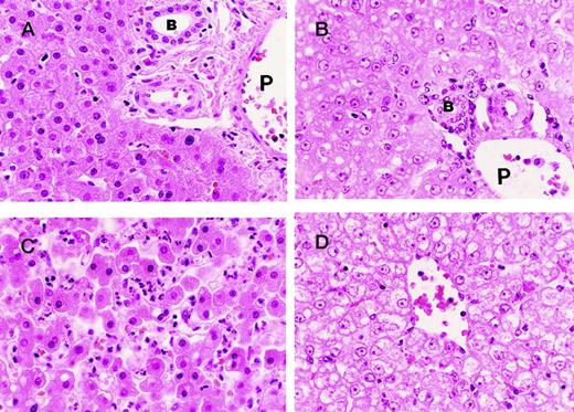 Fig. 4. Photographs of sections of the liver from baboons injected with sublethal doses of E coli and blocking anti-EPCR mAbs. / In the “early” animals (ie, animals with relatively short survival) the portal areas of the liver (A) are quite unremarkable with well-preserved architecture showing the bile duct (B), portal vein (P), hepatic artery, and numerous hepatocytes. The centrilobular regions (C) of the liver from the “early” animals exhibit prominent PMN infiltrate in association with necrobiotic/necrotic changes of scattered hepatocytes. The “late” changes (ie, changes in animals with relatively long survival) consist of “open” nuclei (ie, nuclei with pale chromatin pattern) and prominent nucleoli in the hepatocytes both in the portal (B) and centrilobular (D) regions and vacuolar degeneration of the hepatocytes more severe in the centrilobular area (D). Note (B) the well-preserved portal structures with bile duct (B), hepatic artery, and portal vein (P). Note also the lack of PMN infiltrate in the centrilobular area (D).