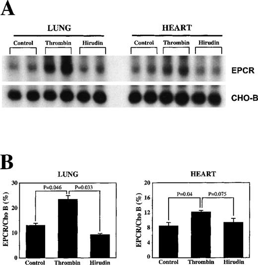 Fig. 5. Increases in EPCR mRNA levels in rat lungs with infusion of thrombin. / Bovine thrombin (5 U/kg infused per hour) and hirudin (100 U/kg infused per hour) were infused into the femoral vein of rats, and the lungs and hearts were removed 3 hours later for the extraction of total RNA. (A) Northern blot analysis. (B) Below the Northern blot is the quantitation of the change based on normalization of the signal of EPCR mRNA to that of CHO-B mRNA on the PhosphorImager.