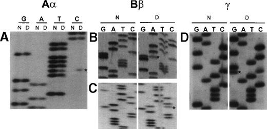 Fig. 3. Unique fibrinogen gene sequence variations detected in subject from Dunedin. / Abnormal bases are denoted by an asterisk. Lanes labeled N correspond to normal control sequence, while those labeled D are from propositus. Nucleotide positions are based on the numbering in the respective Genbank entries M64 982 (Aα), M64 983 (Bβ) and M10 014 (γ). (A) Sequence surrounding nucleotide 3237 in intron 4 of the Aα-chain gene obtained with the forward primer Fn3003γ (5′-TTACAGACAAATCACTCAGCAGCT-3′). Dunedin subject is heterozygous for a T→C transition. (B) Sequence surrounding nucleotide 5906 in exon 5 of the Bβ-chain gene obtained with the reverse primer Fn6050β (5′-GTATGGACATTAAGGTCGTG-3′). Dunedin subject is heterozygous for a G→A (coding strand C→T) transition, which predicts the substitution Bβ235 P→L. (C) Sequence surrounding nucleotide 8525 in the 3′ untranslated region of the Bβ-chain gene obtained with the reverse primer Fn8610β (5′-TGAACATTCCTTCCTCTTCG-3′). Dunedin subject is heterozygous for an A→C transversion. (D) Sequence surrounding nucleotide 2525 in exon 4 of the γ-chain gene obtained with forward primer Fn2479γ (5′-GGATTTTTATGTCTCTGATC-3′). Dunedin subject is heterozygous for a C→G transversion, which predicts the substitution γ82 A→G.