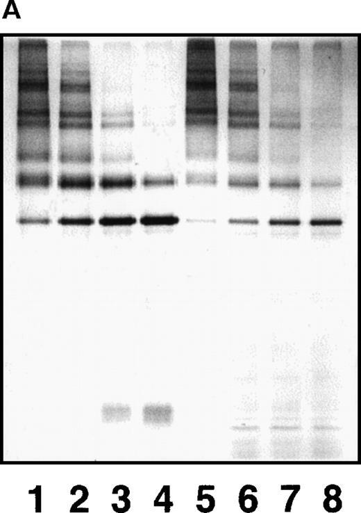 Fig. 7. Epitope expression by a combination of GE and plasmin. / Effects on the epitope expression for IF-123 are noted by further digestion of GE-XDP by plasmin (A) and plasmic XDP by GE (B). The 2 XDP fractions were digested by respective enzymes at 37°C, and samples removed at various timed intervals were analyzed by SDS-PAGE under nonreducing conditions before and after immunoprecipitation with IF-123–conjugated Sepharose. Lanes 1 and 5, 0 minutes; lanes 2 and 6, 15 minutes; lanes 3 and 7, 60 minutes; and lanes 4 and 8, 120 minutes.