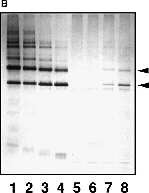 Fig. 7. Epitope expression by a combination of GE and plasmin. / Effects on the epitope expression for IF-123 are noted by further digestion of GE-XDP by plasmin (A) and plasmic XDP by GE (B). The 2 XDP fractions were digested by respective enzymes at 37°C, and samples removed at various timed intervals were analyzed by SDS-PAGE under nonreducing conditions before and after immunoprecipitation with IF-123–conjugated Sepharose. Lanes 1 and 5, 0 minutes; lanes 2 and 6, 15 minutes; lanes 3 and 7, 60 minutes; and lanes 4 and 8, 120 minutes.