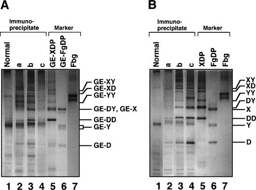 Fig. 10. SDS-PAGE analyses of immunoprecipitated GE digests and plasmic digests in 3 representative plasma samples. / (A) In sample a, GE digests are elevated but plasmic digests are low. In sample b, both GE and plasmic digests are elevated. In sample c, GE digests are low but plasmic digests are elevated. Individual fragments in the GE digests are termed according to their corresponding fragments assigned for plasmic digests.1620 (B) Purified samples are shown as reference.