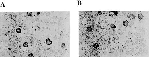 Fig. 1. Light micrographs of peritoneal mast cells from control mice (A) and mice deficient in protein kinase Cβ(B). / Peritoneal exudates were stained with Alcian blue and counterstained with safranin.