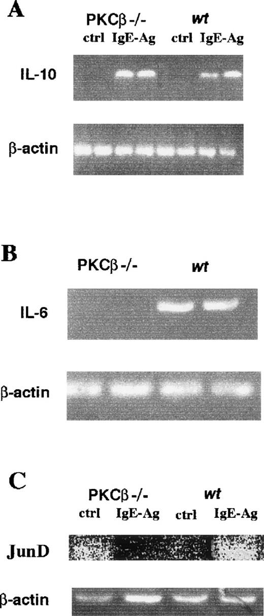 Fig. 6. IgE-Ag–mediated interleukin 10 (A), interleukin 6 (B), and JunD (C) mRNA accumulation in bone marrow mast cells from PKCβ-deficient and wild-type mice. / RNA isolated from IgE-Ag–stimulated mast cells was reverse transcribed with specific primers and then amplified. Polymerase chain reaction products were resolved on 2% agarose gel containing 0.008% ethidium bromide.