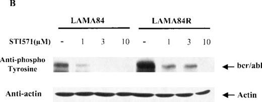 Fig. 4. Expression, phosphorylation status, and enzymatic activity of bcr/abl in LAMA84 and LAMA84R cells. / (A) The expression of endogenous bcr/abl and actin in extracts of LAMA84 and LAMA84R cells treated with 0.6 μM of STI571 or left untreated (control) was determined by Western blot analysis using the monoclonal anti-abl and the polyclonal anti-actin antibodies, as described in “Materials and Methods.” (B) The bcr/ablphosphorylation status in LAMA84 and LAMA84R cell lysates treated with 1, 3, and 10 μM of STI571 or left untreated (control) was examined by immunoblotting using the monoclonal anti-phospho tyrosine antibody, as mentioned in “Materials and Methods.” The level of actin expression in the same lysates was detected as described above. (C) Immunocomplex kinase assay of bcr/abl in LAMA84 and LAMA84R. Cell lysates from both cell lines were immunoprecipitated with an anti-Abl antibody. The immunoprecipitates were left untreated (control) or treated with 3 μM STI571 and then subjected to an in vitro kinase assay as described under “Materials and Methods.” The upper panel shows the bcr/abl autophosphorylation level. The bcr/abl kinase activity was determined as GST (negative control) and GST-CH1 Shc phosphorylation (middle panel). Total cell lysates were subjected to Western blot analysis using anti-actin antibody to demonstrate equal protein levels in the samples analyzed (lower panel).