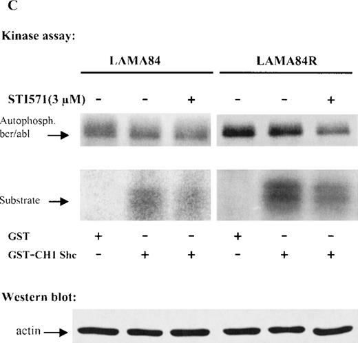 Fig. 4. Expression, phosphorylation status, and enzymatic activity of bcr/abl in LAMA84 and LAMA84R cells. / (A) The expression of endogenous bcr/abl and actin in extracts of LAMA84 and LAMA84R cells treated with 0.6 μM of STI571 or left untreated (control) was determined by Western blot analysis using the monoclonal anti-abl and the polyclonal anti-actin antibodies, as described in “Materials and Methods.” (B) The bcr/ablphosphorylation status in LAMA84 and LAMA84R cell lysates treated with 1, 3, and 10 μM of STI571 or left untreated (control) was examined by immunoblotting using the monoclonal anti-phospho tyrosine antibody, as mentioned in “Materials and Methods.” The level of actin expression in the same lysates was detected as described above. (C) Immunocomplex kinase assay of bcr/abl in LAMA84 and LAMA84R. Cell lysates from both cell lines were immunoprecipitated with an anti-Abl antibody. The immunoprecipitates were left untreated (control) or treated with 3 μM STI571 and then subjected to an in vitro kinase assay as described under “Materials and Methods.” The upper panel shows the bcr/abl autophosphorylation level. The bcr/abl kinase activity was determined as GST (negative control) and GST-CH1 Shc phosphorylation (middle panel). Total cell lysates were subjected to Western blot analysis using anti-actin antibody to demonstrate equal protein levels in the samples analyzed (lower panel).