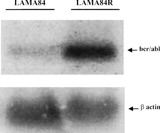 Fig. 6. Determination of BCR/ABL mRNA in LAMA84 and LAMA84R cells. / Samples containing 25 μg of total RNA per lane, extracted from LAMA84 and LAMA84R, were fractionated and analyzed by Northern blotting. A highly specific 40mer, corresponding to a portion of the b3-a2 junction sequence of BCR/ABL,14 was used as a probe and detected an 85-Kb transcript (upper panel). The same membrane was rehybridized with a murine β-actin probe (lower panel).