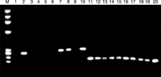 Fig. 3. TβR-II mRNA expression in MSH2−/−murine lymphomas. / RT-PCR was used to assess the expression of TβR-II (lanes 1-10) and TβR-I (lanes 11-20) mRNA in 10 whole lymphoma tumor specimens. Tumor specimens with frameshift mutations in the mononucleotide (A) repeat of TβR-II (lanes 1, 3-6, 9) show absence of TβR-II mRNA transcripts, whereas all other tumor specimens (lanes 2, 7, 8, 10) express TβR-II. All tumor specimens, including those with TβR-II frameshift mutations, show TβR-I mRNA transcripts.