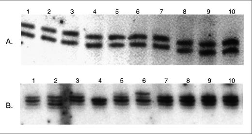 Fig. 6. Microsatellite analysis of MSH2−/− murine lymphoma single cell clones. / (A) Examples of analysis of DNA from single cell clones derived from the R25 cell line at D6Mit8 marker. No microsatellite instability is seen. (B) Examples of analysis of DNA from single cell clones derived from the L15 cell line at D8Mit14 marker. Novel microsatellite alleles are present in 2 of the clones (lanes 2 and 6).