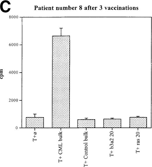 Fig. 2. Unprimed ex vivo proliferation assays of fresh T cells from vaccinated patients. / The assay was conducted as described in “Materials and Methods.” (A) Patient 7 after 5 vaccinations. (B) Patient 7 after 8 vaccinations. (C) Patient 8 after 3 vaccinations. (D) Patient 11 after 5 vaccinations. The stimulus is shown along the x-axis. T+ø, T cells plus APC without peptide; CML bulk is 5 peptides in the vaccine (see Figure 1); control bulk is control peptides (see “Materials and Methods”); b3a2 20 or b3a2 50 is 20μg or 50μg of the long b3a2 peptide (Figure 1); ras 20 or ras 50 is 20μg or 50μg of the control ras peptide (see “Materials and methods”). Standard deviations are shown.