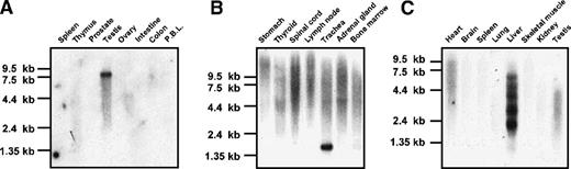 Fig. 2. CEP110 expression. / (A,B) Indicated human poly(A)+ RNA from Clontech Northern blots was hybridized with CEP110 probes either derived from the cDNA insert of CEP110 clone 71 (A) or the 5′ untranslated probe (B). (C) Mouse poly(A)+ Northern blot (Clontech) hybridized with a CEP110 probe from cDNA clone mu38gO2. The marker sizes (in kb) are indicated on the left.